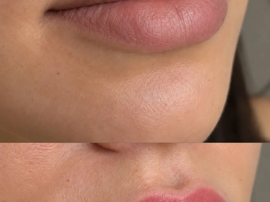 YL.permanentbeautyink, institut de beauté à Casablanca (photo 6)